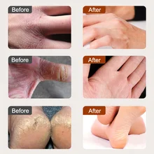 Конский масляный крем для ног для спортсмена ножной зуд волдыри анти-чаппинг пилинг Антибактериальная мазь MH88