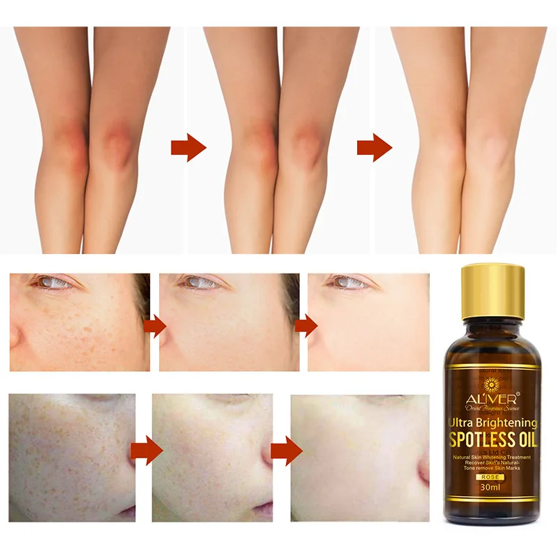 

30ml Pure Natural Essential Ultra Brightening Spotless Oil Dark Spots Fade Away Age Spots Hyper Pigmentation Essential Oil TSLM1