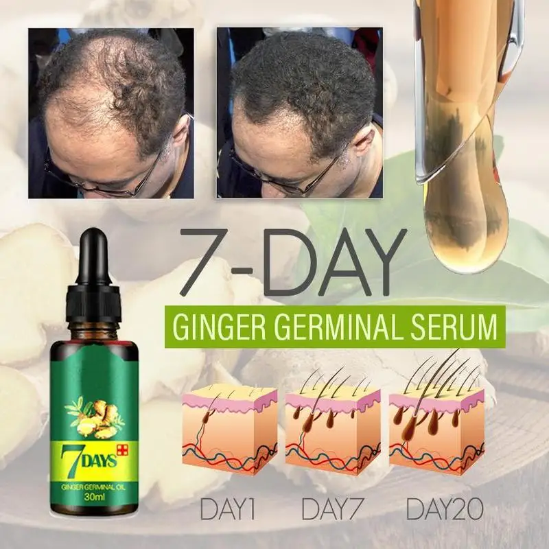 

7 Day Ginger Germinal Serum Essence Oil Natural Hair Loss Treatement Effective Fast Growth Hair Care 30ML