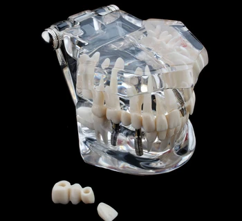 

Human Dental laboratory anatomical teeth anatomy teach brain model gift implant prices skull equipment juguetes dentales