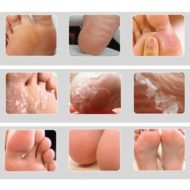 baby foot where to buy in australia