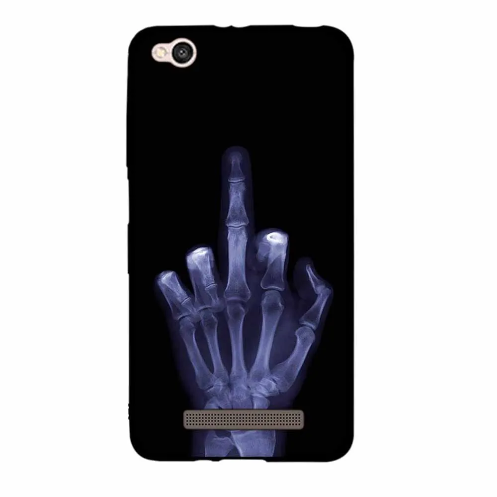 Case For Xiaomi Redmi 4A Case Silicon Back Cover Soft TPU Capa Funda Coque Shell Bumper Cat Cartoon Mobile Phone Case Protective