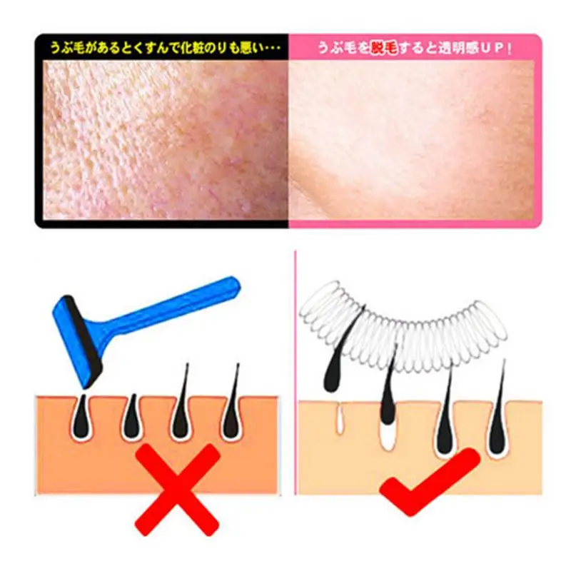 Депиляция. Девушка с эпилятором. Эпилятор бритьё ног. Как эпилятор удаляет волосы. Эпилятор и депилятор разница.