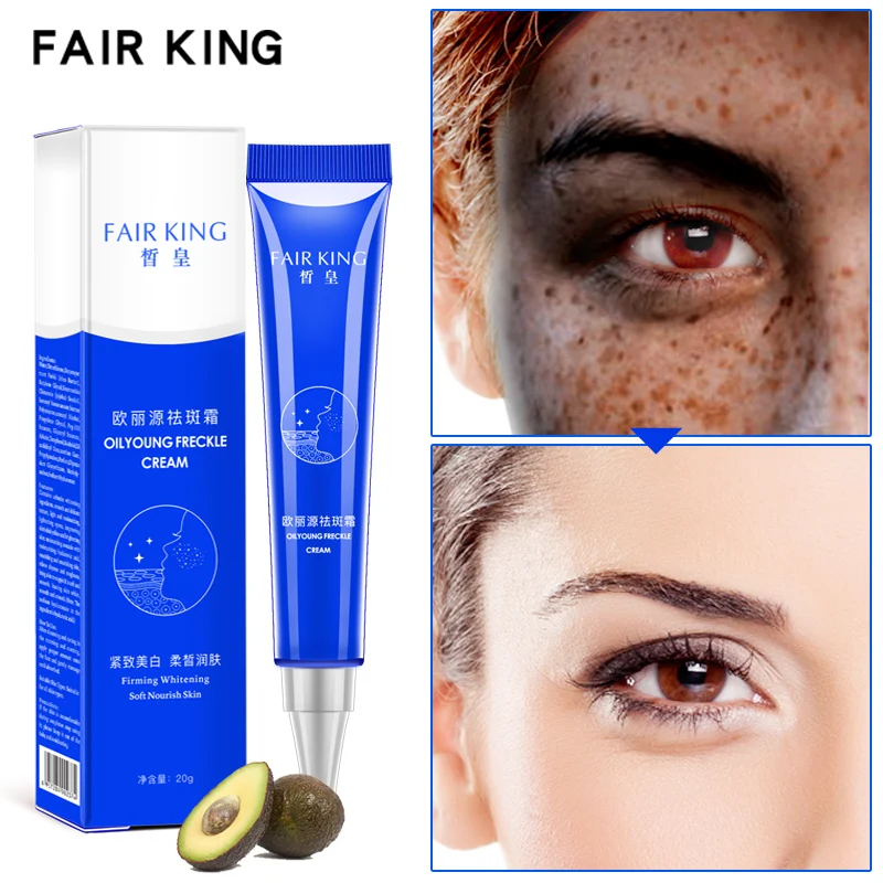 

Strong Effects Powerful Whitening Freckle Cream 20g Remove Melasma Acne Spots Pigment Melanin Face Care Cream