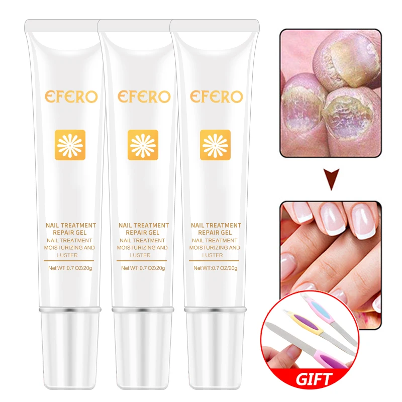 

EFERO Nail Protector Toe Skin Care Cream Nail Fungus Treatment Repair Cream Nail Nourishing Gel Brighten Nail Care Tools
