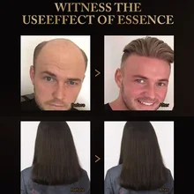 Марокканское масло для волос для завивки сухих волос Кератиновое лечение кератиновые волосы секущиеся концы кондиционер QS888