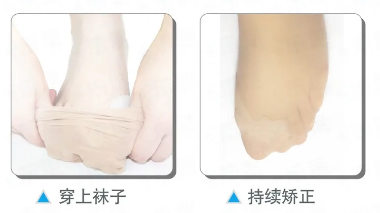 2 шт силиконовый прибор для лечения грудных пузырей для пальцев ног реабилитация вальгусной деформации корректор для ухода за ногами разделитель для пальцев ног