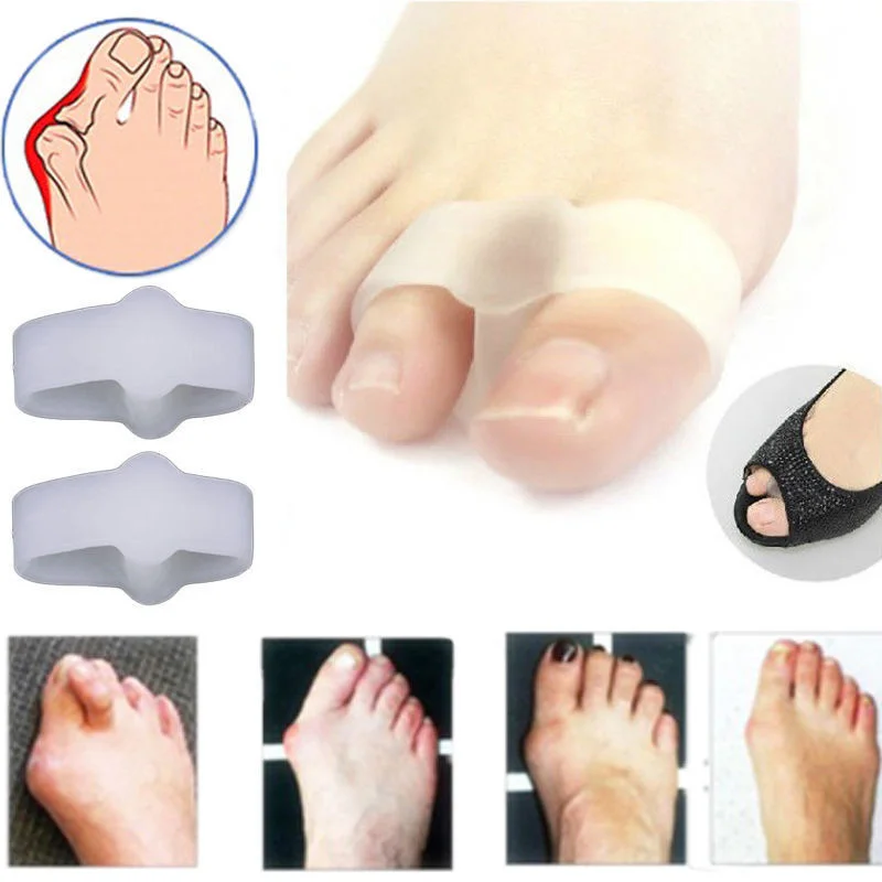 1 пара Силиконовый гелевый для ног пальцы два отверстия носок сепаратор косточка на большом пальце профилактика бурсита регулятор профилактика «косточек» на ноге Уход за ногами
