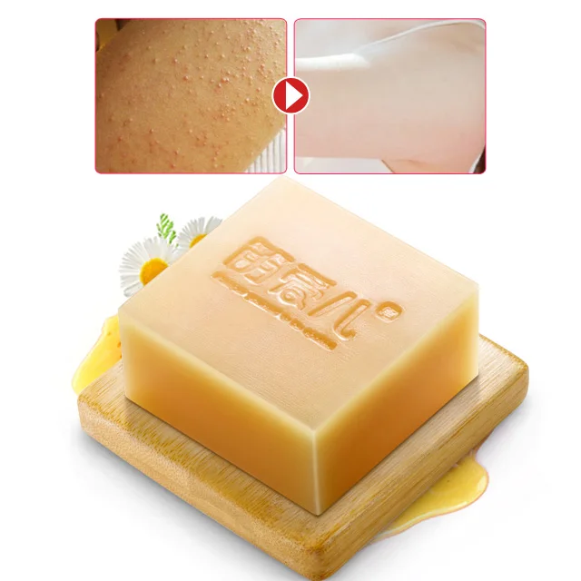 

1pcs Chamomile Handmade Soap Remove Blackhead Shrink Pore Face Cream Acne Treatment Face Wash Whitening Natural Bath Soap 120g