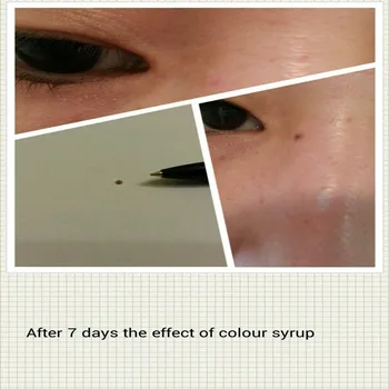 

NEW DIY BODY FACE MOLE REMOVER VANISH WART NEVUS BODY DEMO NON LASER SKIN CARE Free Shipping