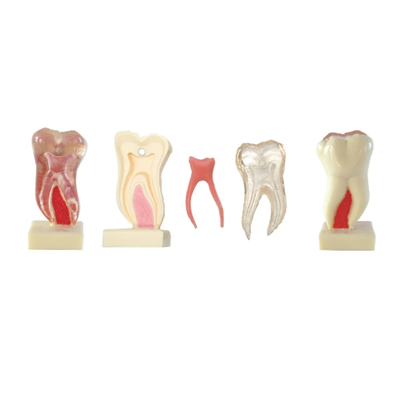 

6Times Anatomic Profile Model of Mandibular for dental laboratory