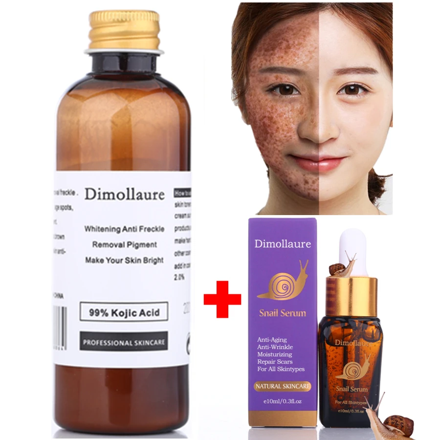 

Dimollaure 30g pure Kojic Acid whitening cream+Snail Hyaluronic acid serum removal Acne scar pigmentt melanin Moisturizing