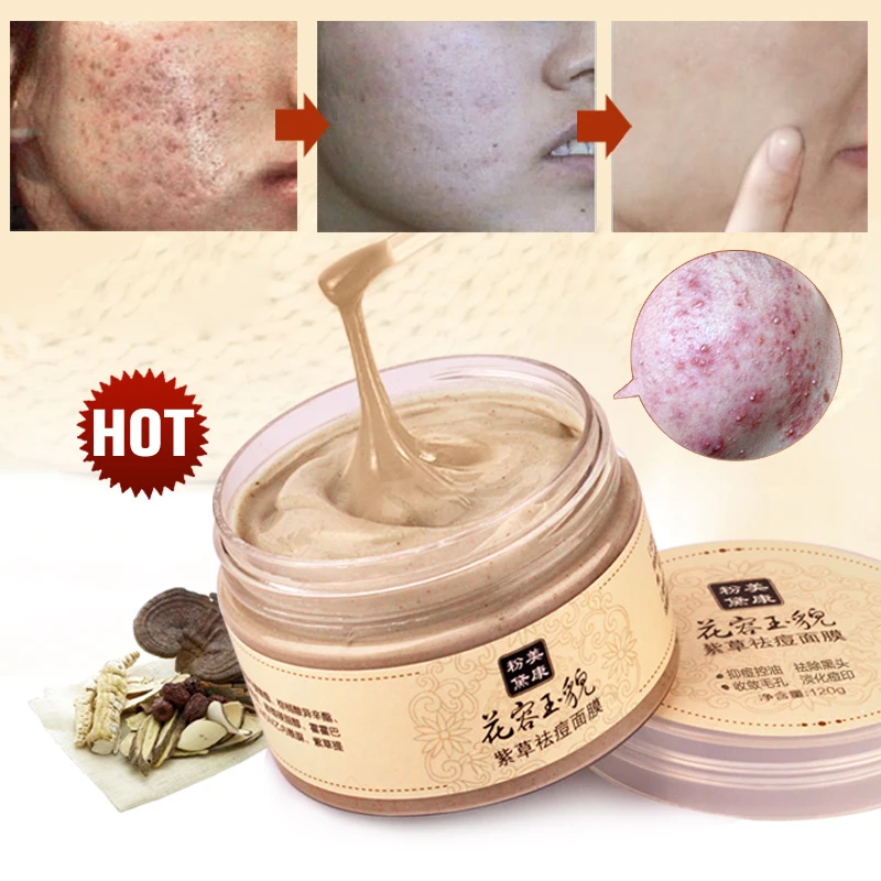 

MEIKING Face Mask Skin Care Whitening Acne Treatment Remove Blackhead Acne Facial Masks sleep Cleaning Moisturizing Type 120g