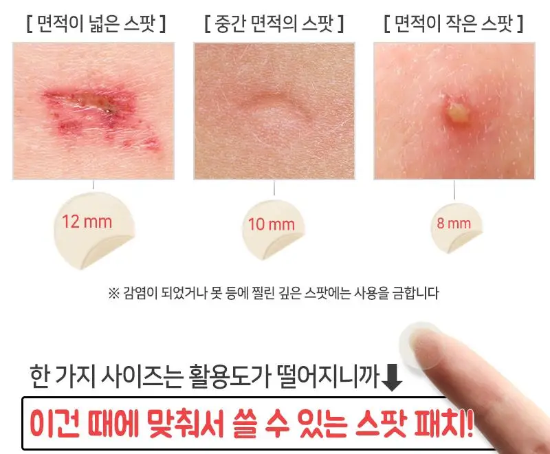ELIZAVECCA ведьма Копилка Hell Pore пятна пятно патч 44 шт маска для лица шрам ремонт прыщей