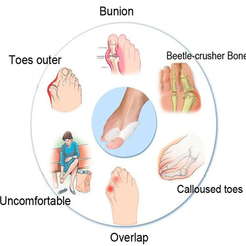 Силиконовый разделитель для пальцев ног/Уход за ступнями пальцев ног Seperator Bunion Corrector Hallus Valgus большая коррекция кости Hallux Valgus ортопедический силиконовый коврик Z20701