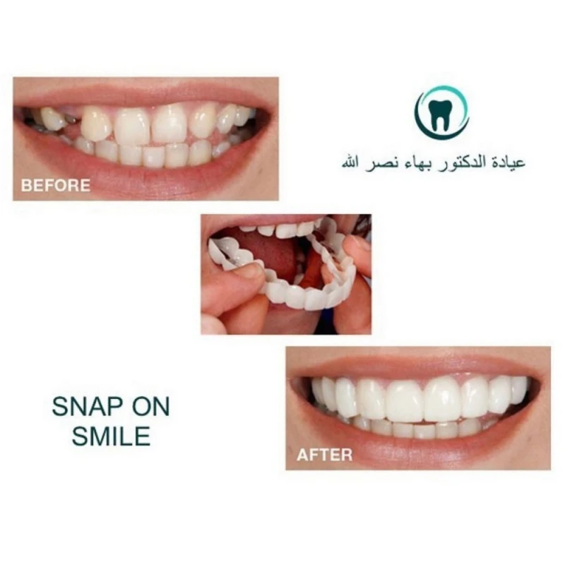 

Reusable Adult Denture Perfect Smile Whitening Denture Fit Flex Cosmetic Teeth Top Dental Veneers Comfortable Oral Care Products