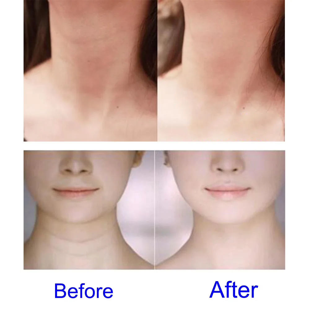 

Neck Care Pad Silicone Anti Wrinkle Aging Reusable Transparent Pads JS88