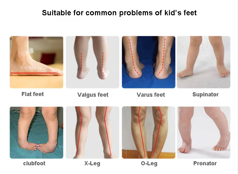 Children Orthopedic Insole Flat Foot 