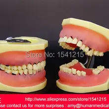 Стоматологические зубы, стоматологические зубные протезы, Обучающие модели зубов, Стоматологическая модель зубов, зубные зубы-GASEN-DEN012