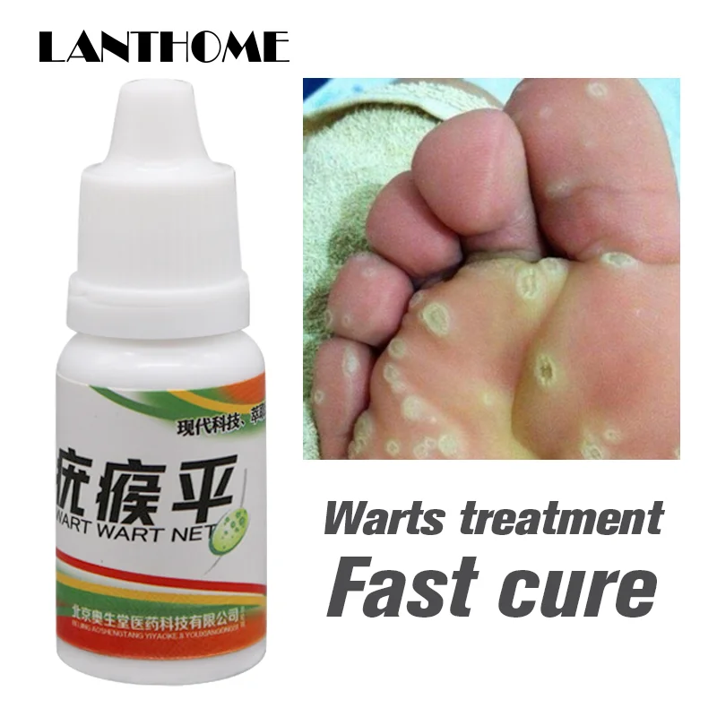 

2019 NEW Upgrade Body Warts Corn Mole Genital Wart Treatment Cream Skin Tag Remover Foot Corn Removal Plantar Warts 10ML