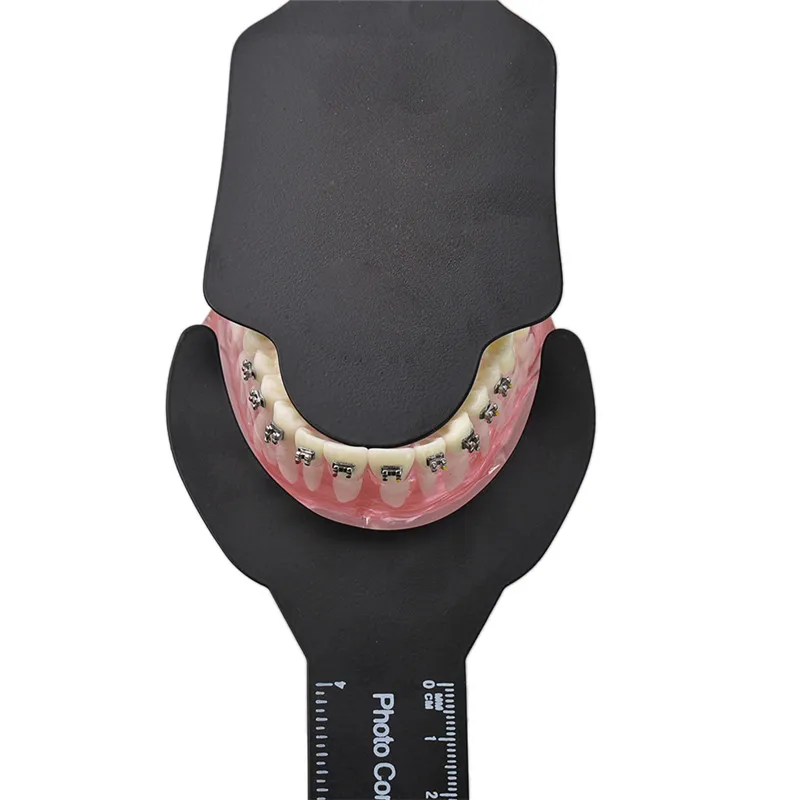 6pcs Dental Orthodontic Black Background Photo Image Contrast Board Oral Cheek Plate with Scale Mark Autoclavable Dentist Tools 6pcs Dental Orthodontic Black Background Photo Image Contrast Board Oral Cheek Plate with Scale Mark Autoclavable Dentist Tools