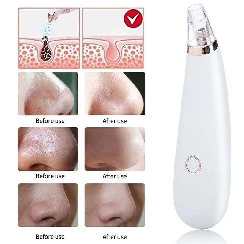 

White Blackhead Beauty Apparatus Clear Black Head Cleaner Fashion Acne Blackhead Removal Equipment Fast Beauty Dorpshipping