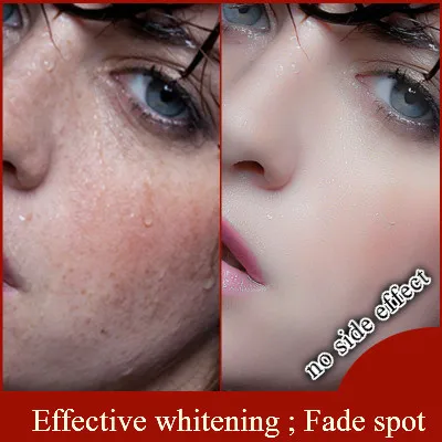 no side effects whitening cream