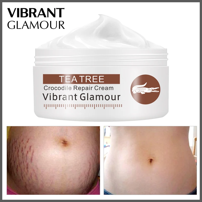 

VIBRANT GLAMOUR Crocodile Dispel Scar Repair Face Cream Remove Acne Scar Stretch Marks Treatment Skin Lightening Whitening Care