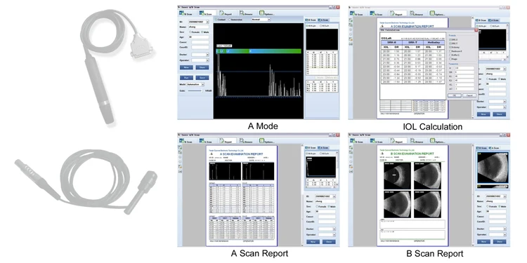 SW-2100 офтальмологическая ультразвуковая сканирующая машина a b сканирующая с usb-подключением