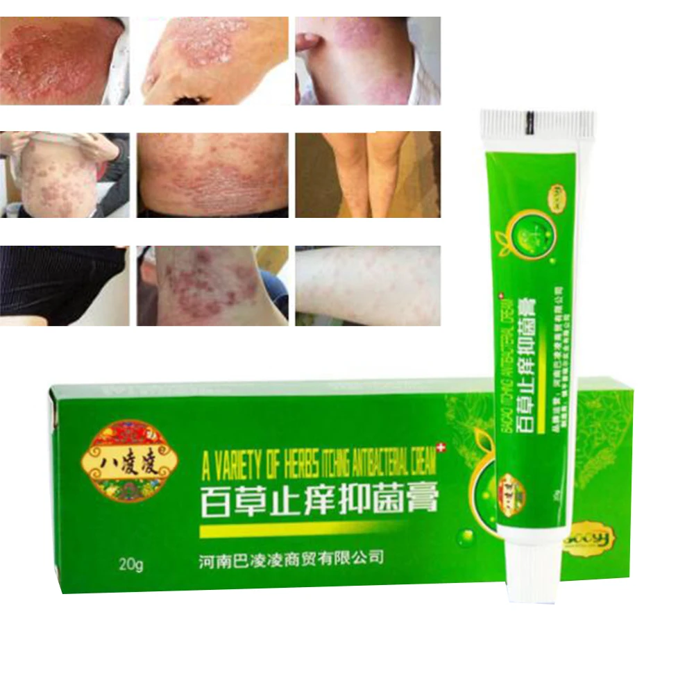 

20g Natural Chinese Medicine Herbal Anti Bacteria Cream Psoriasis Eczema Ointment Treatment High Quality Herbal Cream D166