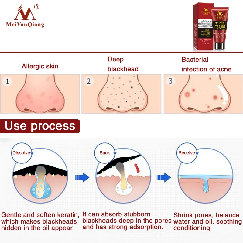 Откачивания вулканической грязи черная маска Уход за лицом для удаления угрей, акне лечение отбеливающий увлажняющий крем для ухода за кожей, отшелушивающая маска для лица Уход за кожей