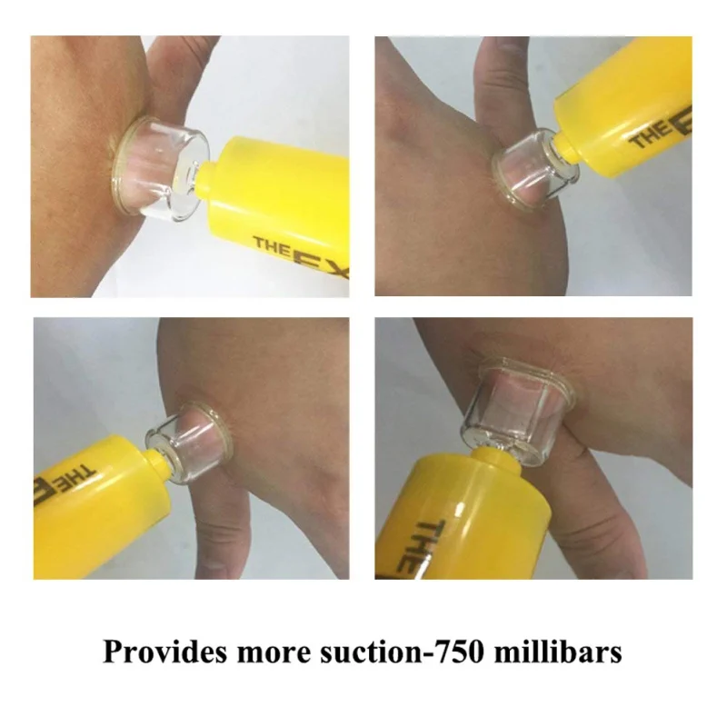 1 set New Camping Survivor Venom Extractor Suction Pump Kit Safe Bite Sting First Aid Kit Safety Venom Protector Snake bees Bite