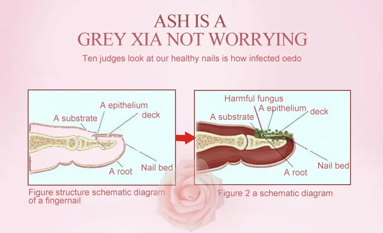 2 шт./лот Лечение ногтей эфирное масло для рук и ног отбеливание пальцев ног удаление грибка ногтей инфекция Уход за ногами лак для ногтей гель