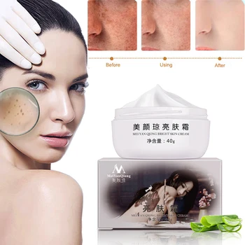 

3pcs Anti AgingStrong Effect Powerful Whitening Freckle Face Cream Remove Melasma Acne Spots Pigment Melanin Dark Spots