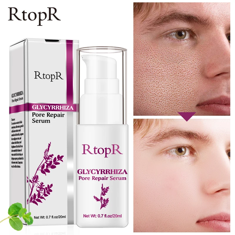 

RtopR Glycyrrhiza Pore Refining Serum Quickly And Effectively Shrinks Pores Deeply Repairs Whitening Skin Enhances Facial Shine