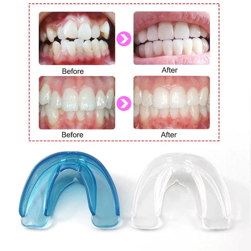 

1Pcs Teeth Whitening TPE Dental Appliances Tooth Alignment Braces Teeth Straight Orthodontic Dental Retainer Tooth Care Tool