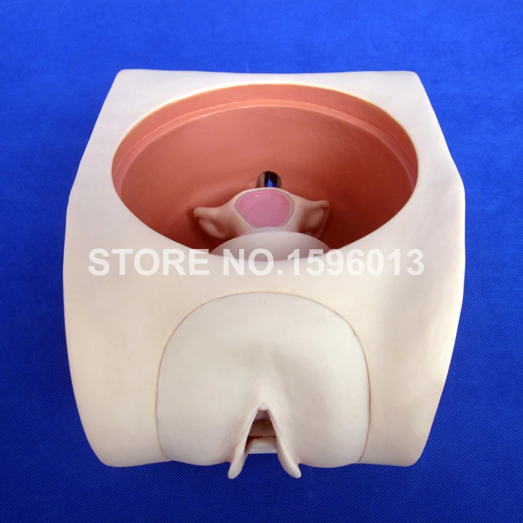 T33B contraception model (1)