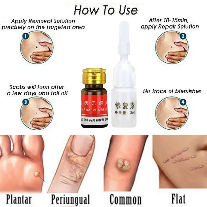 

Face Care Mole Removal Cream Painless 3.0ml Scar Remover Professional Repair Solution Acne Treatment Oil
