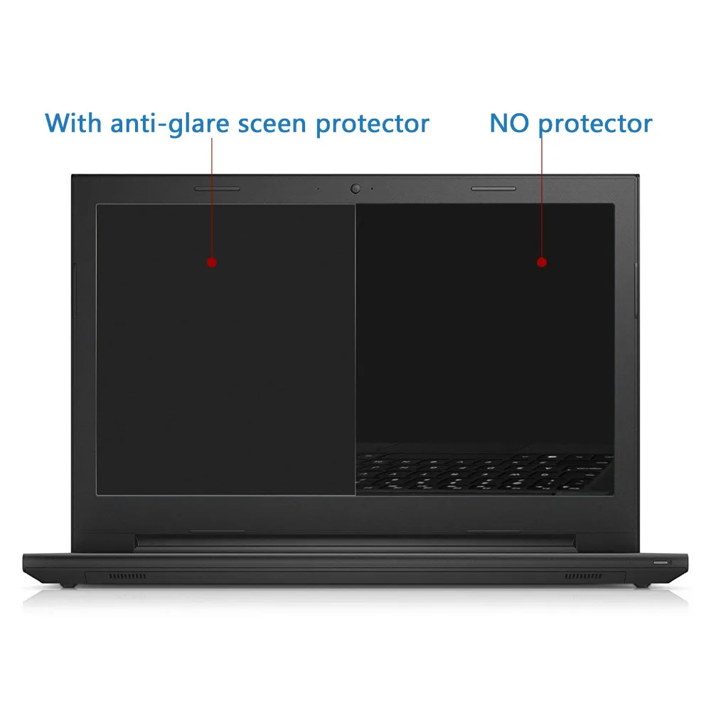 Anti Glare Laptop Screen Protector, Matte LCD Screen Guard Film for ASUS VivoBook Flip 14 TP401C TP401N 14\ Anti Glare Laptop Screen Protector, Matte LCD Screen Guard Film for ASUS VivoBook Flip 14 TP401C TP401N 14\