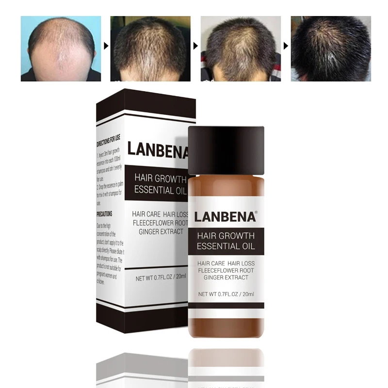 

Fast Hair Growth Essential Oil Essence Product Treatment Preventing Hair Loss Hair Care Fleeceflower Root Ginger Extract 20ml
