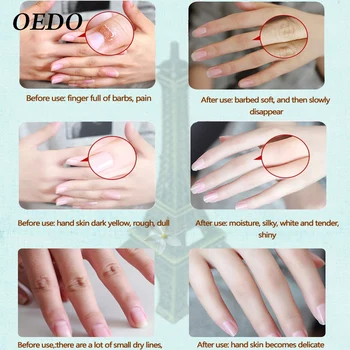 OEDO Hand Cream Rose Peptides Snow Lotus Set Antifreeze Moisturizing Hydra Repair cream Anti Wrinkle