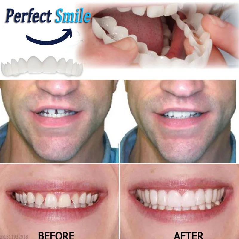 Защелкивающиеся на зуб идеальная улыбка накладные зубы виниры верхняя комфортная посадка гибкие зубы подходит для большинства удобных косметических накладных зубов