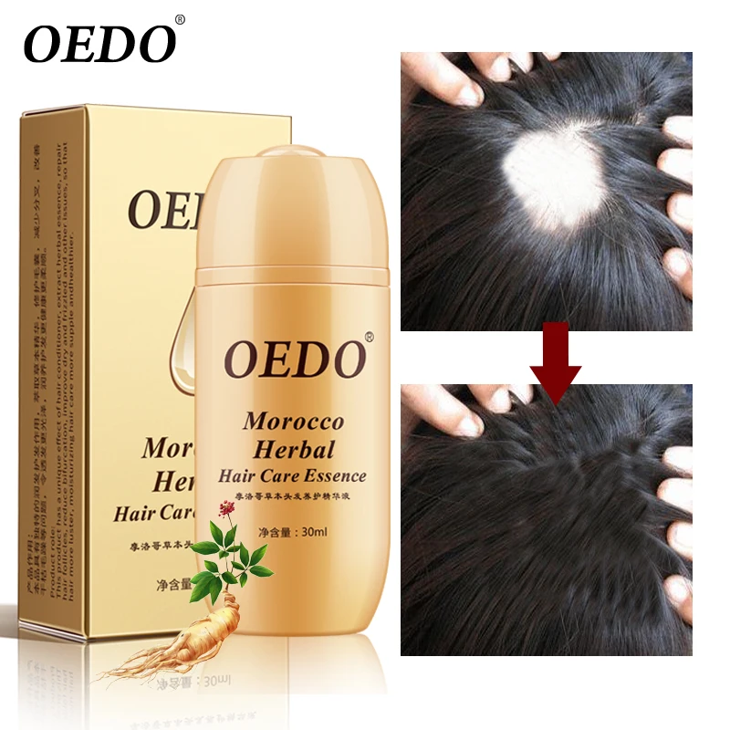 

Moroccan Hair Loss Treatment Ginseng Ginger Hair Growth Oil Herbal For Dry Hair Care Types Scalp Herbal Treatment Essence