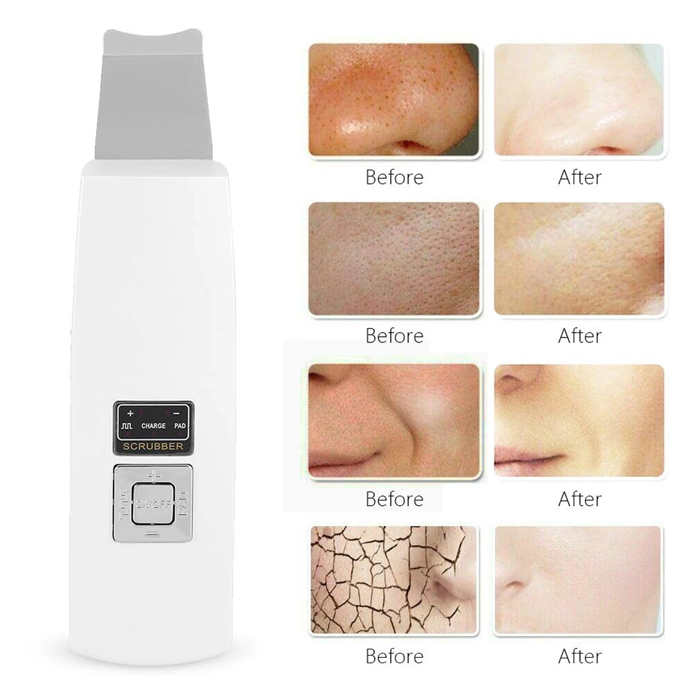  Ultrasonic Deep Face Cleaning Skin Scrubber Remove Dirt Blackhead black point Reduce Wrinkles and s