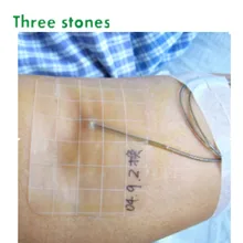 4X4 дюйма безопасная гидроколлоидная повязка на рану, очень тонкая, без латекса для язвы, пролежней, кормящих стерин