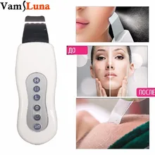 Ультразвуковая чистка лица- аппарат для лица