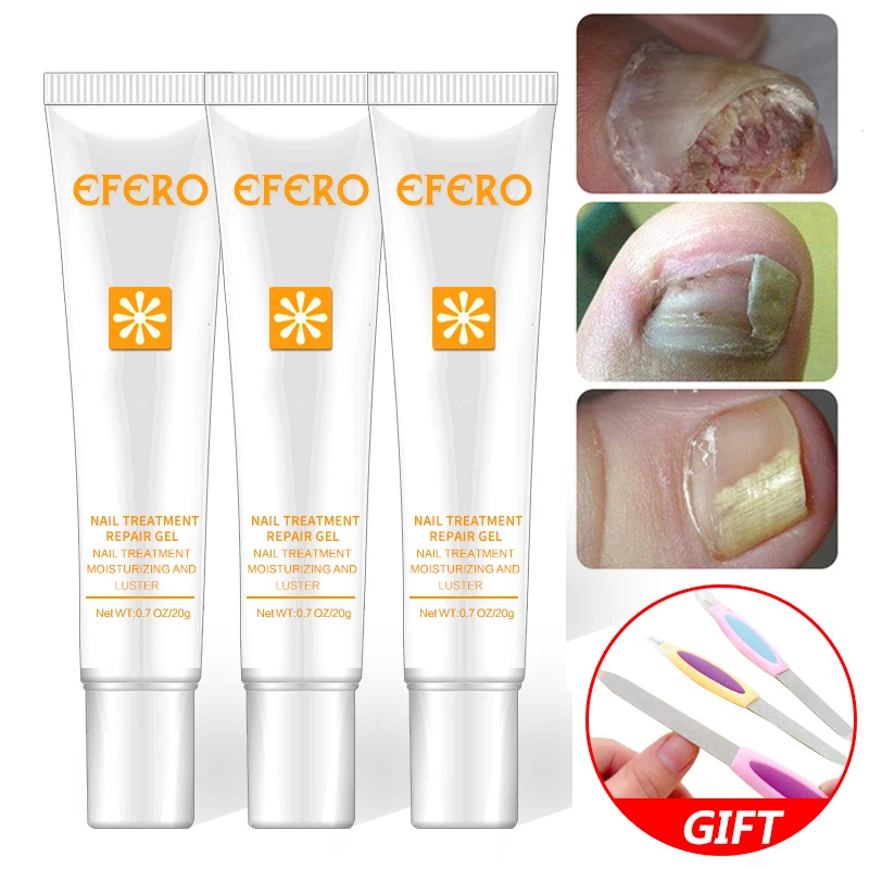 

efero Nail Repair Essence Oil Foot Fungal Nail Treatment Skin Care Remove Onychomycosis Whitening Hand Toe Nails Repair Serum