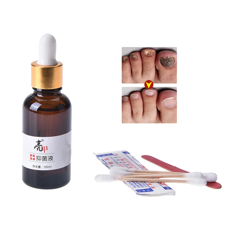30ml Nail Care Lotion Chinese Medicine Herbs Toe Nail Fungus Treatment