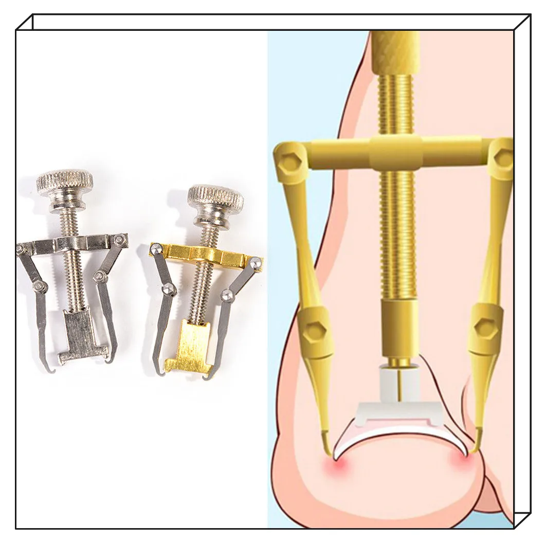 Foot Nail Care Orthotic Nail Bunion Corrector Ingrown Toe Nail Correction Tool Manicure Clipper Pedicure Fixer Recover Hot