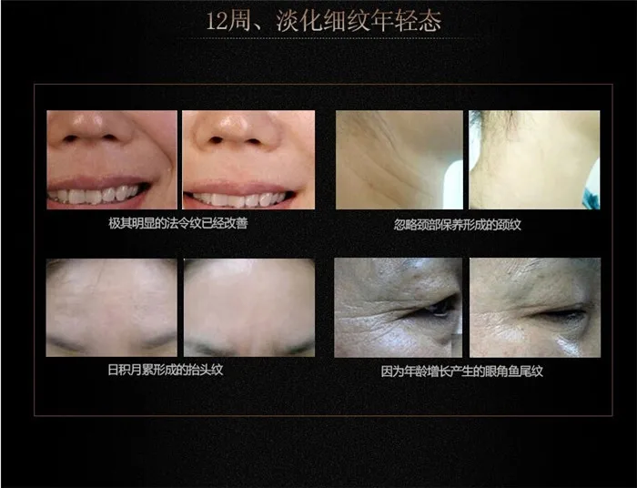QQ20141108072814.jpg
